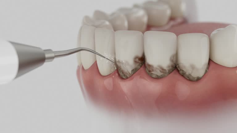 Reliable Dental contractor in Wauna, WA by Dentist Open Now